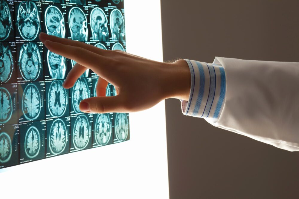 Brain Injury Lawyer San Jose, CA